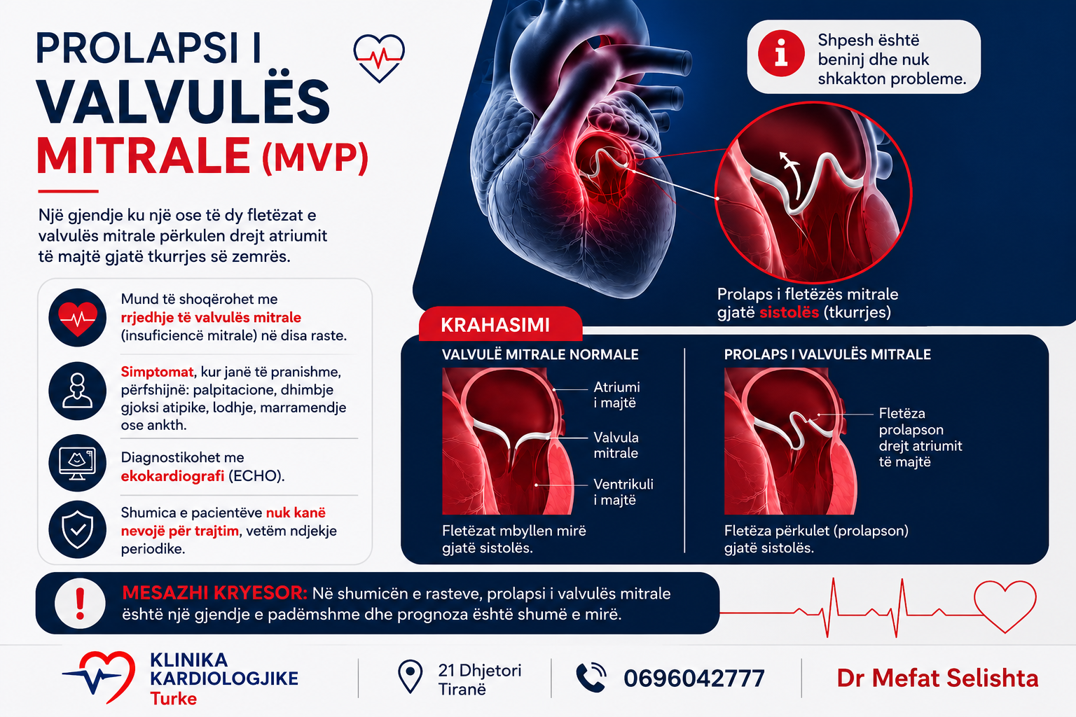 Prolapsi i Valvulës Mitrale (MVP): Simptomat, Diagnostikimi dhe Trajtimi | Klinika Kardiologjike Turke